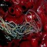 Heartworms