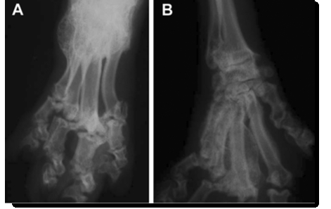 osteochondrodysplasia