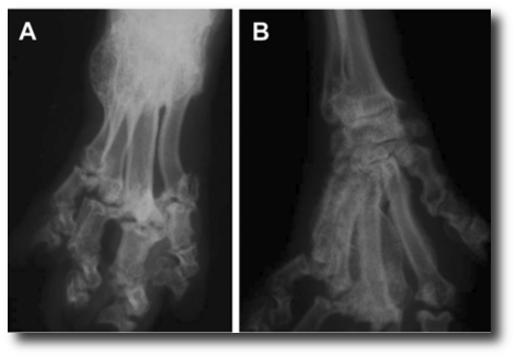 osteochondrodysplasia