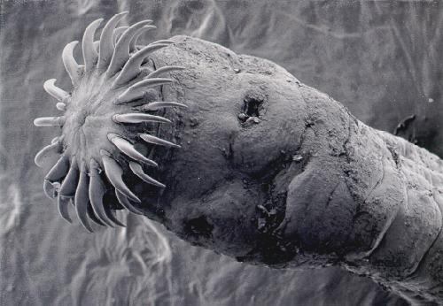 tapeworm head